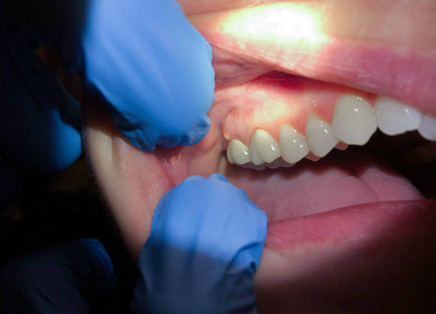 Best Pediatric Emergency Dentist in Ethete, WY